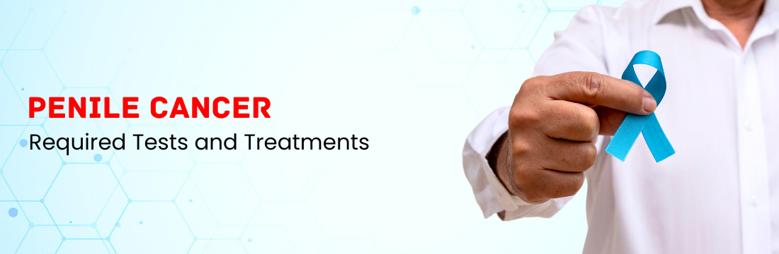 Penile Cancer Tests and Treatments